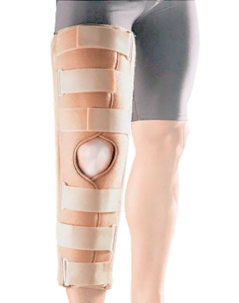 фото Ортопедическое изделие бандаж на коленный сустав oppo medical 51cm размер xl 4030-20xl